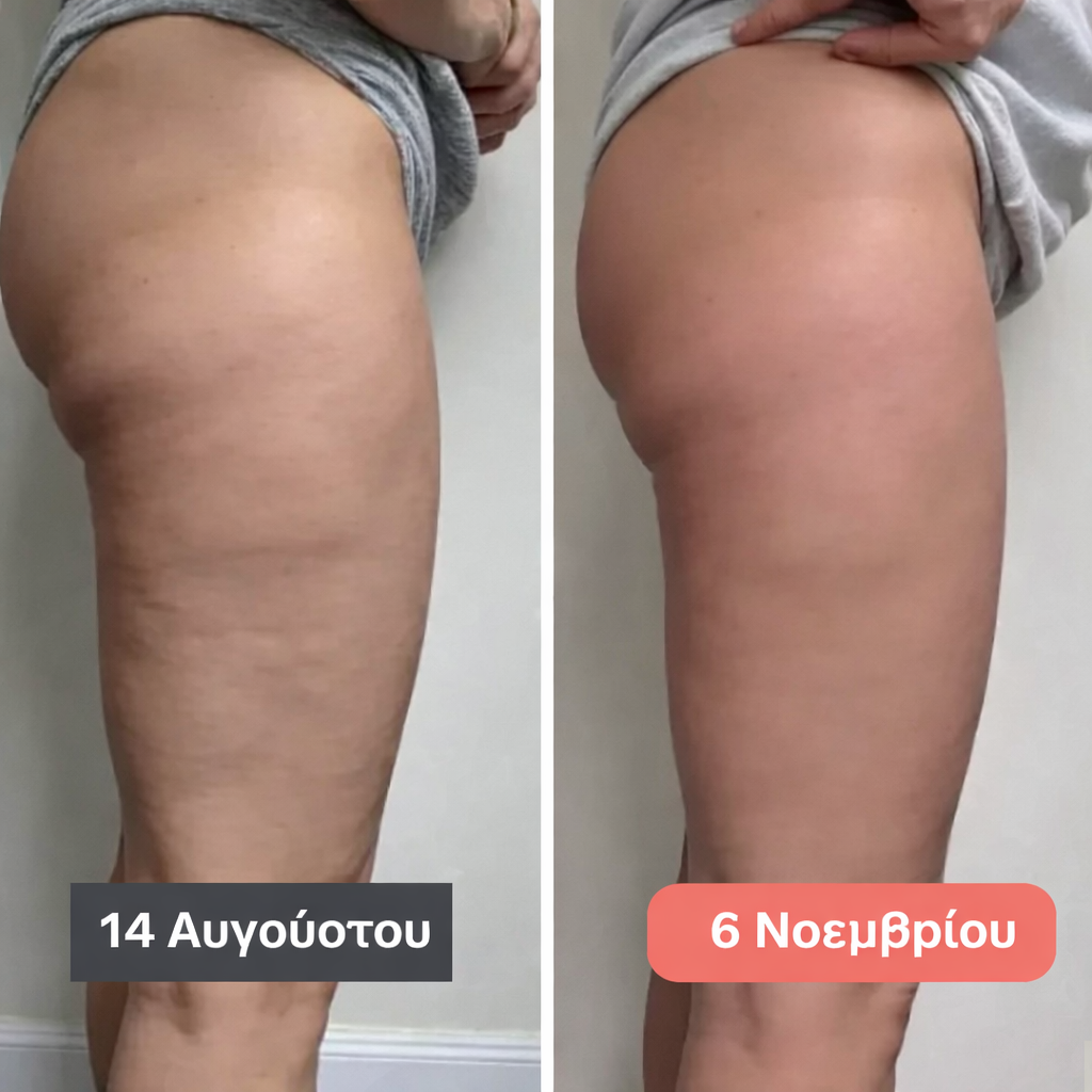 Leggings 3D Fittabella – Ridefinisci la tua silhouette senza alcuno sforzo.
